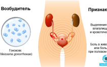 Белые творожистые выделения без запаха с зудом у женщин: причины появления и возможные заболевания